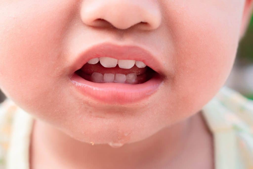 Frenectomy Procedures: Addressing Tongue-Tie and Lip-Tie